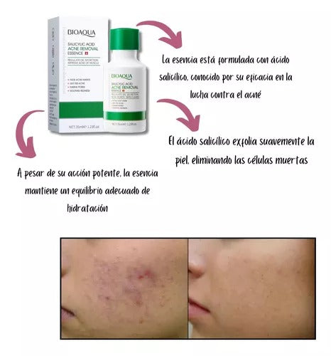 Esencia Acido Salicilico Antiacné Bioaqua 35 ml SKU